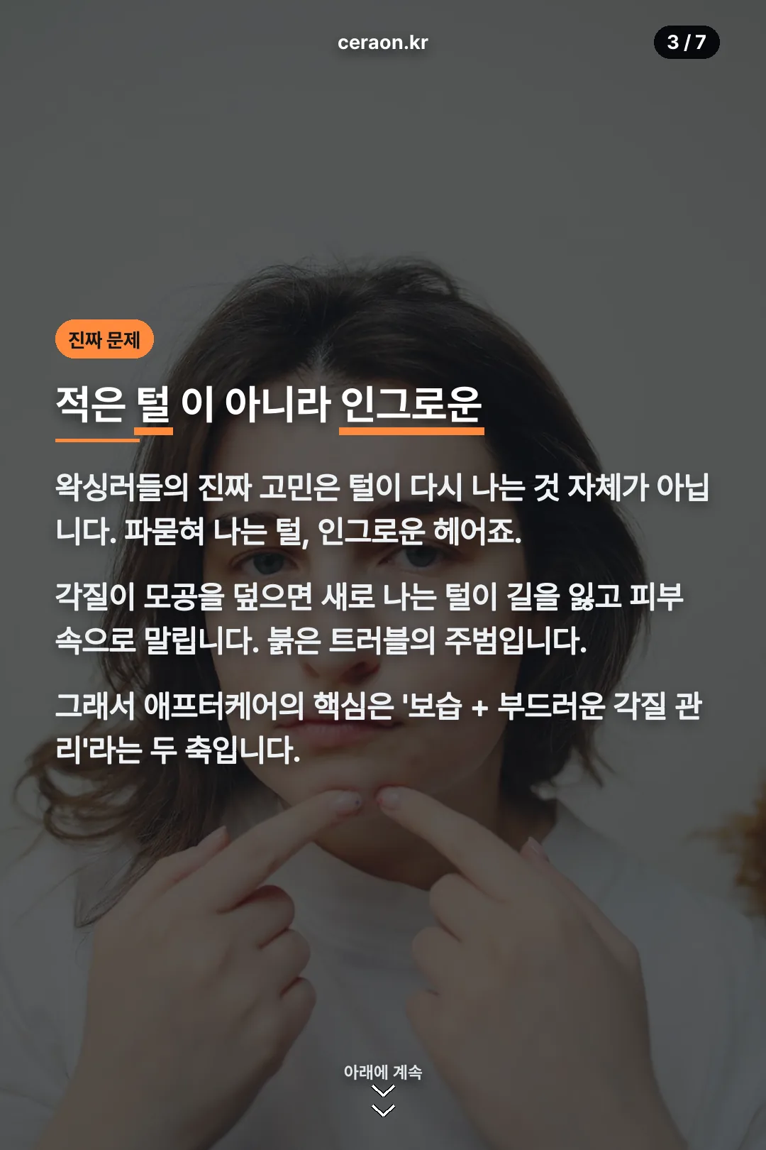 인그로운 헤어 문제 설명